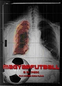 Magyarfutball, a 91. perc DVD
